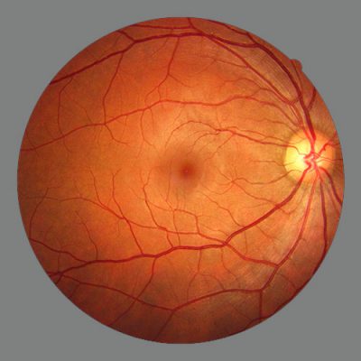 visite_esame_del_fundus_oculi